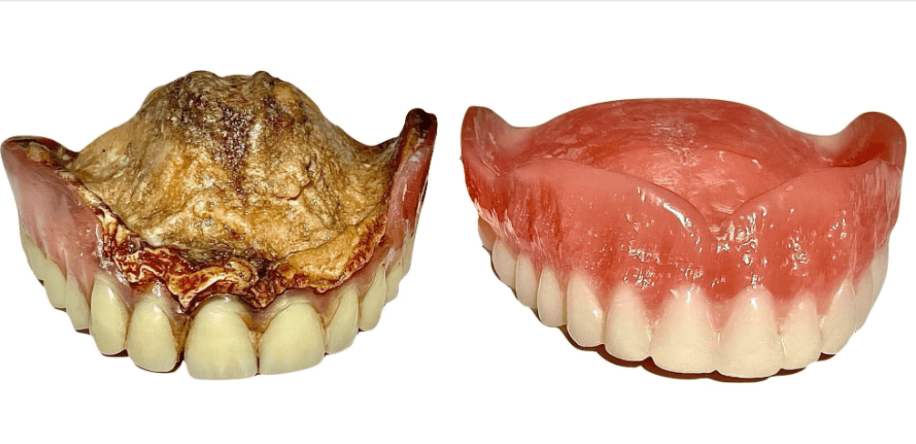 Old dentures and new dentures from Denture Care Shop.