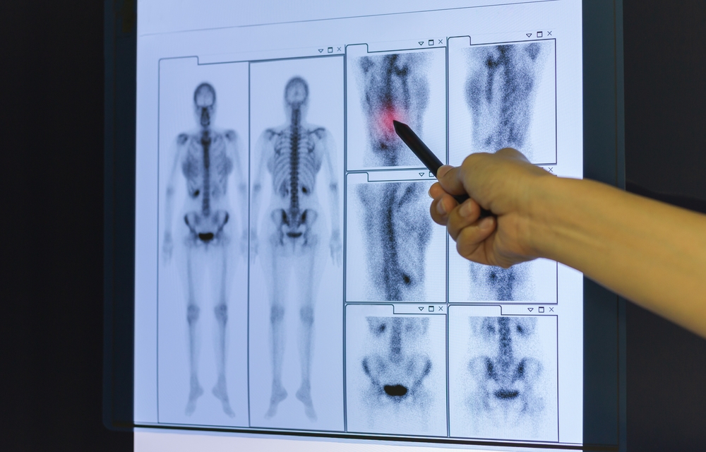 Bone densitometry technologist