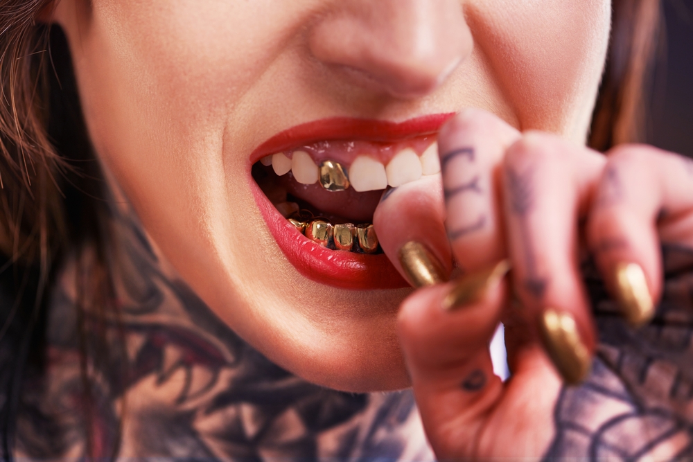 gold teeth in mouth of woman