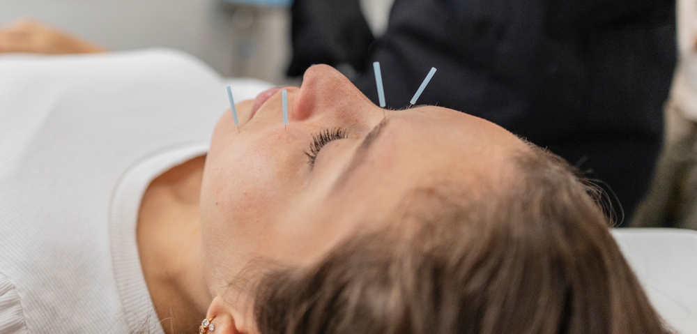 acupunture
